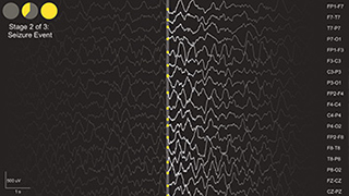 A several rows of zigzagging lines visualizing EEG brain wave data